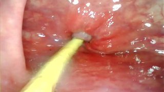 EXTREME ANAL SELF PERSPECTIVE. WEB CAMERA INSIDE HER ASS-HOLE AS I POUND HER WITH MY HUMONGOUS MEAT AND JIZZ DEEP INSIDE