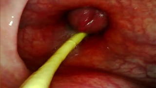 EXTREME ANAL POINT OF VIEW. WEB-CAM INSIDE HER ASS-HOLE AS I POUND HER WITH MY GIANT DONG AND JIZZ DEEP INSIDE