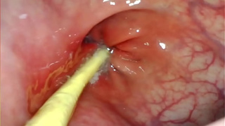 EXTREME ANAL POINT OF VIEW. WEBCAM INSIDE HER ANUS AS I POUND HER WITH MY LARGE ROD AND JIZZ DEEP INSIDE